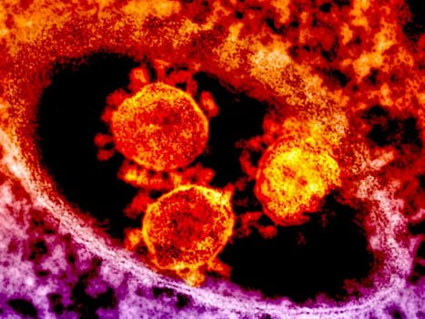 "MERS Coronavirus Particles" by National Institutes of Health (NIH) is licensed under CC BY-NC 2.0